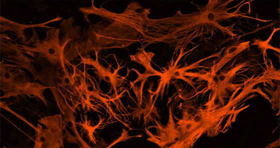 Медицинские нейротехнологии - новый профиль в магистратуре МБФ по биологии